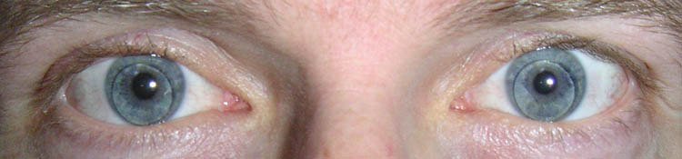 Intensiver Augenblick